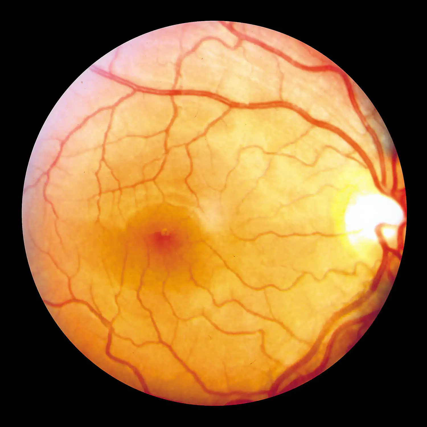 rétine de l'oeil rétine de l'oeil