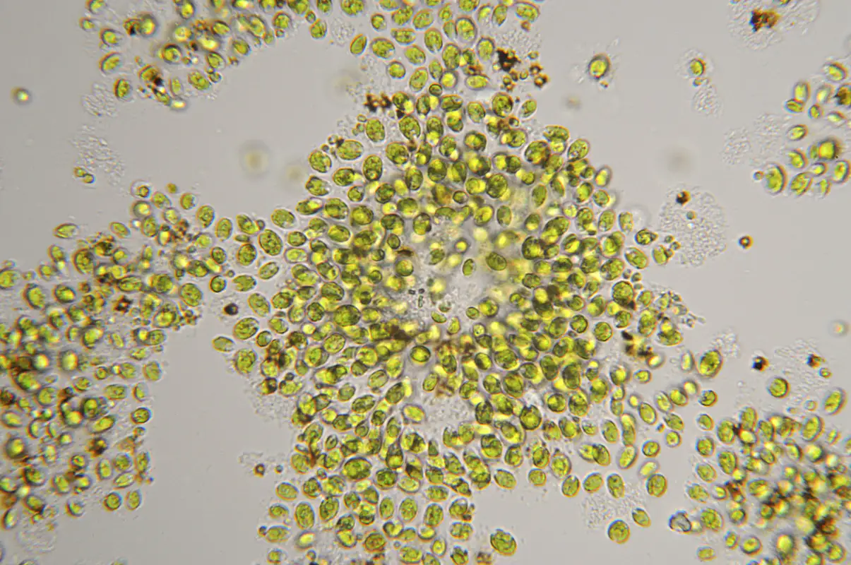 Chlorella vulgaris au microscope Chlorella vulgaris au microscope